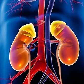 Kidney Cancer