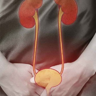 Urinary Incontinence