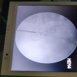 x-ray1