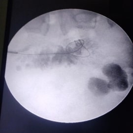 x-ray2