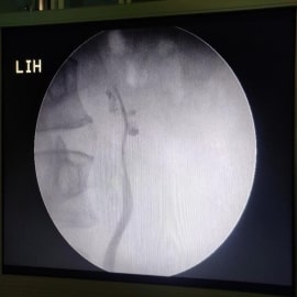 x-ray3