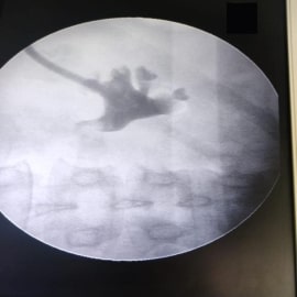 x-ray4