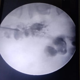 x-ray5