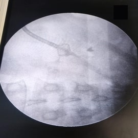 x-ray6